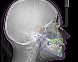 Oral Diagnoz Hizmeti