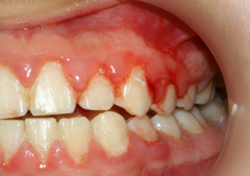 Periodontoloji Hizmeti